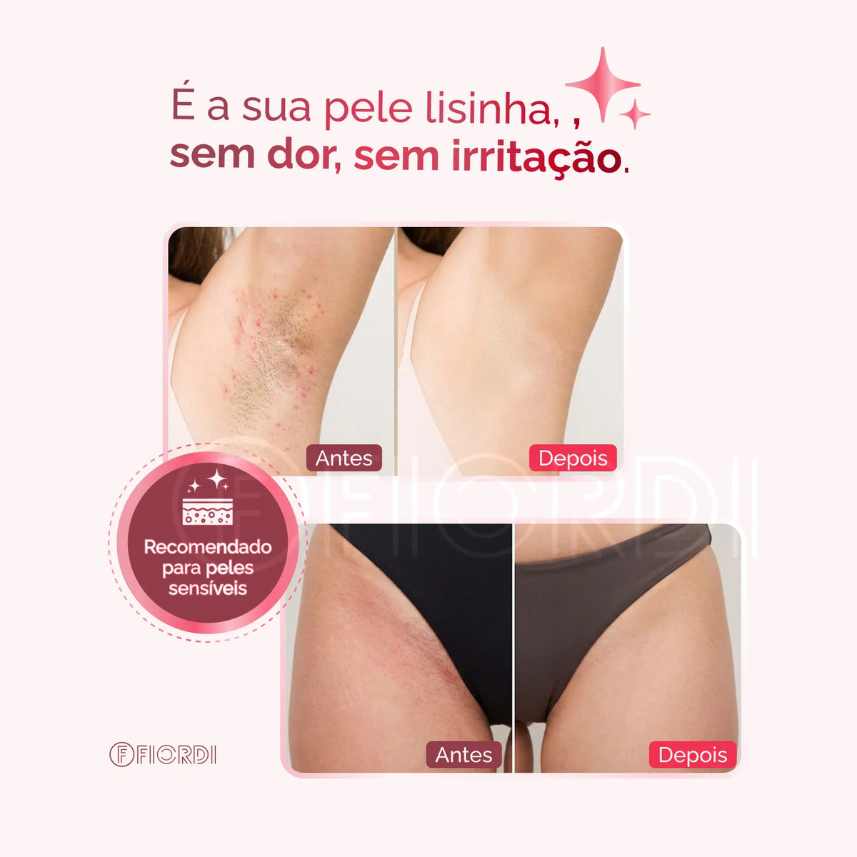Depilador Elétrico 4 em 1 - DermaFlex™