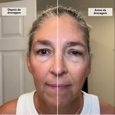 GlowFace - Escova de Drenagem Linfática Facial