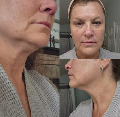 GlowFace - Escova de Drenagem Linfática Facial