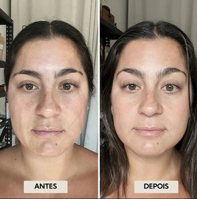 GlowFace - Escova de Drenagem Linfática Facial