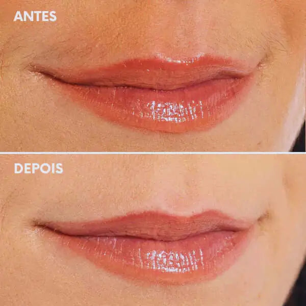 Depilador Facial DermaGlide - Remova pelos do rosto de forma rápida e indolor